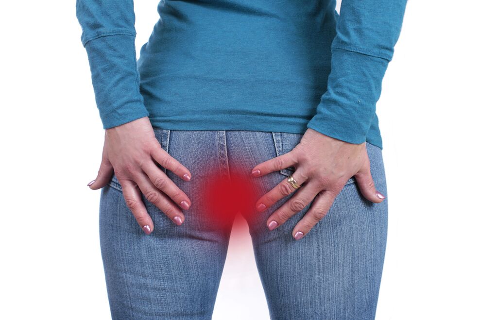Symptomer vun Hämorrhoiden